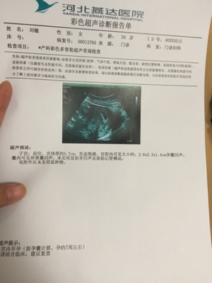一根输卵管能怀孕吗