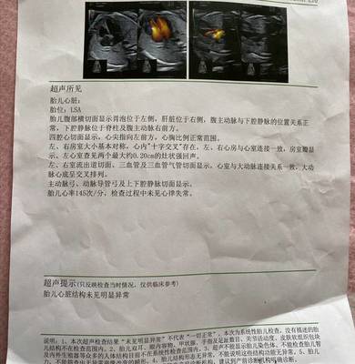 胎儿心跳太快怎么回事