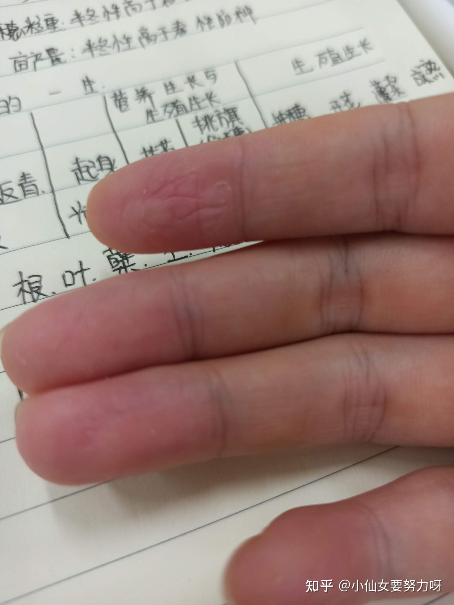 手指上起皮是怎么回事