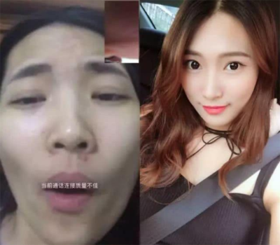 男生鼻子长痘痘的原因