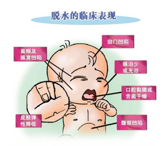 宝宝轮状病毒症状