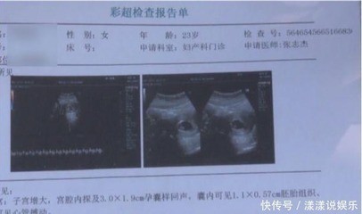 全麻之后多久可以怀孕