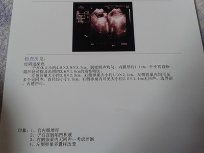 无优势卵泡竟然怀孕了