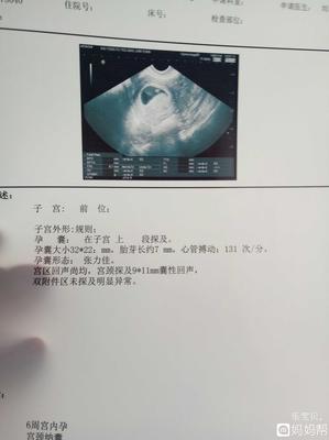 宫颈囊肿可以怀孕吗