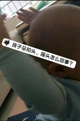 八个月宝宝喜欢摇头