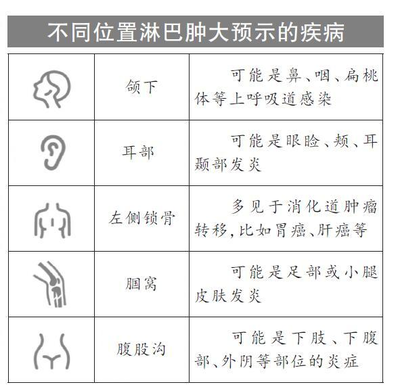 淋巴发炎是怎么回事