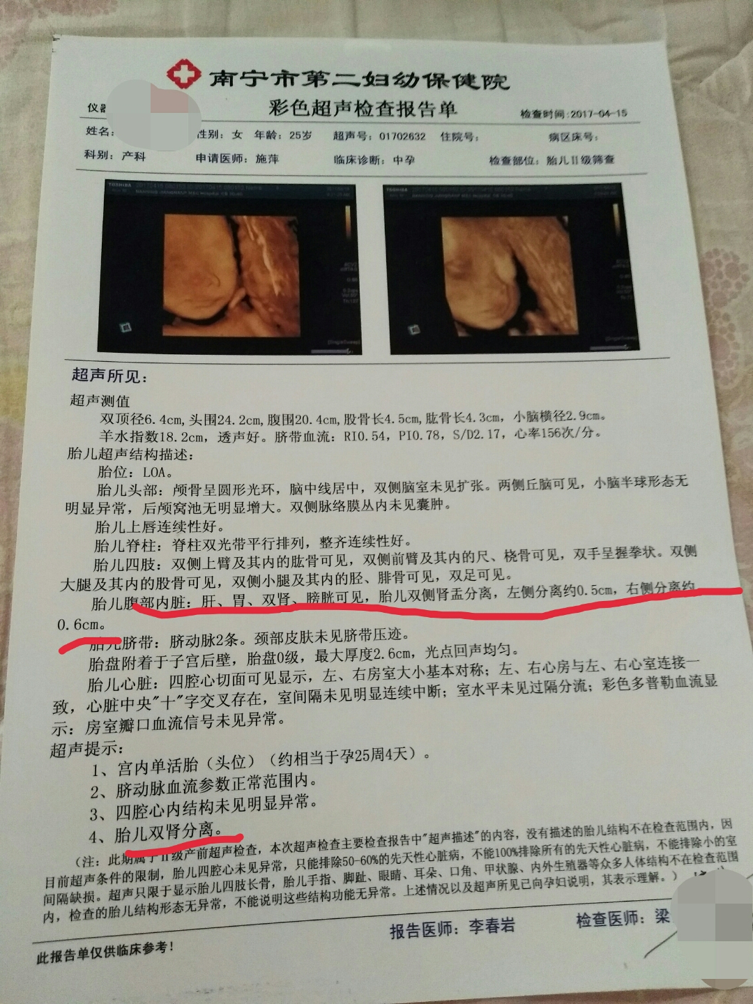 胎儿肾盂分离是什么意思