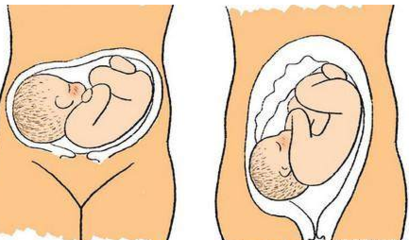 八个月胎儿臀围怎么办
