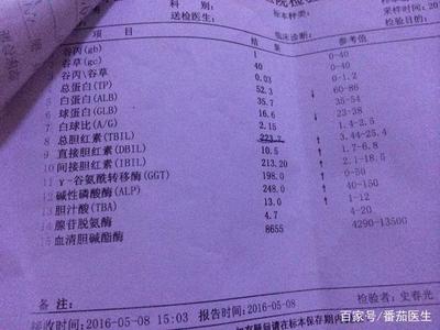 小儿黄疸值正常是多少正常