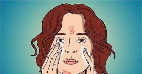 刚冒的痘痘怎么处理