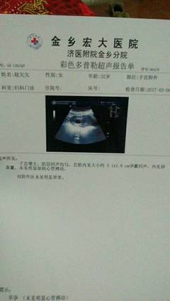 两个月没有胎心