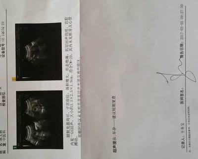 怀孕七周可以做人流吗