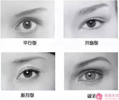 定点双眼皮价钱