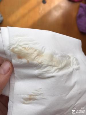 白带淡粉色是怎么回事