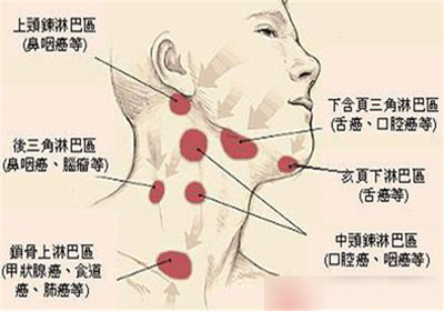 脖子两侧淋巴疼是怎么回事