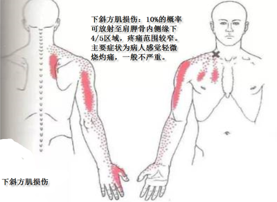 左边肩膀疼是怎么回事