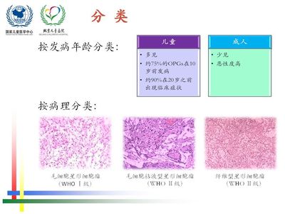 纤维组织瘤手术多少钱