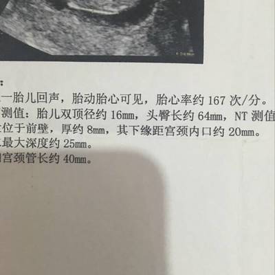 胎儿双顶径一月长多少正常吗