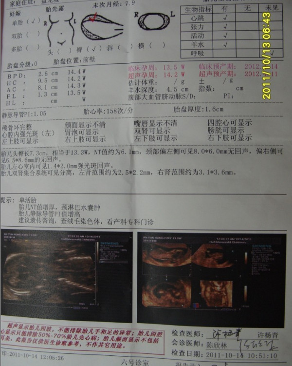 怀孕四个月可以引产吗