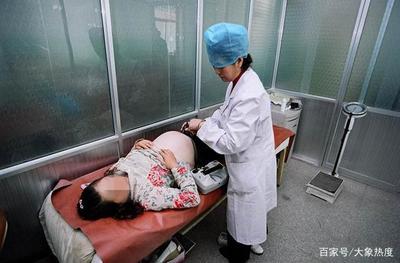 孕妇可以要求剖腹产吗