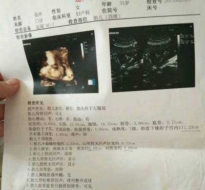 胎儿心脏彩超检查什么内容