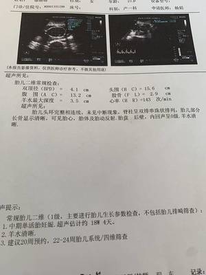 二十周的胎儿有多大