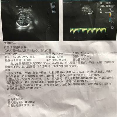 宝宝做核磁共振