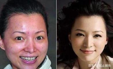 女的脸上长痘痘