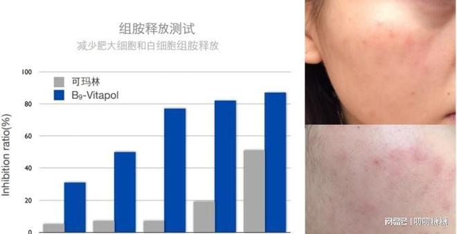 备孕期间可以打玻尿酸吗