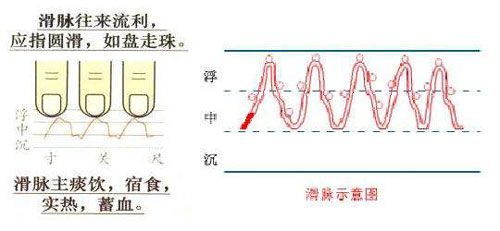 怀孕脉象图解