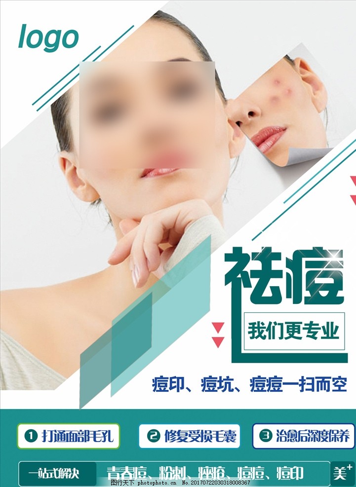 美容院能治好痘痘吗