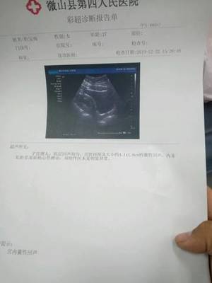 怀孕四十天彩超图片