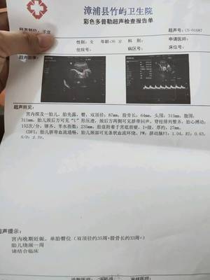 32周胎儿