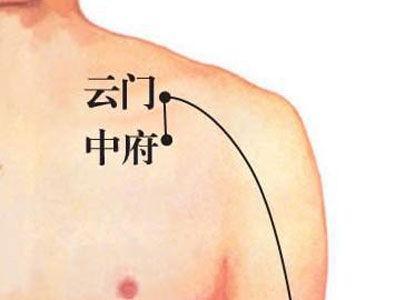 锁骨部位疼是怎么回事