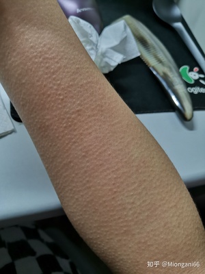 头蹦蹦的疼是怎么回事