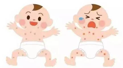 小孩的湿疹怎么治疗最好方法