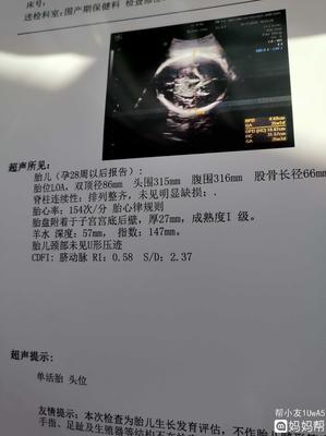 35周胎儿图片