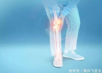关节炎怎么治疗