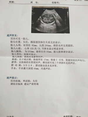 胎儿头位是入盆了吗