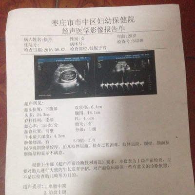 怀孕25周胎儿有多大