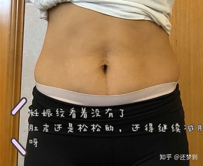 梦见我又怀孕了