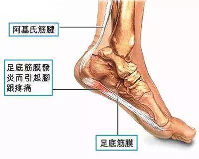 足底疼是怎么回事