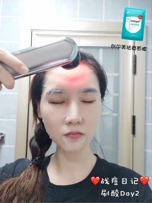 痘痘肌可以光子嫩肤吗