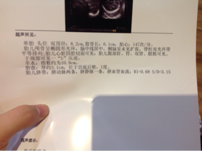 怎么计算胎儿身高