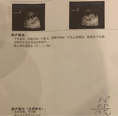 怀孕四个月胎动不明显正常吗