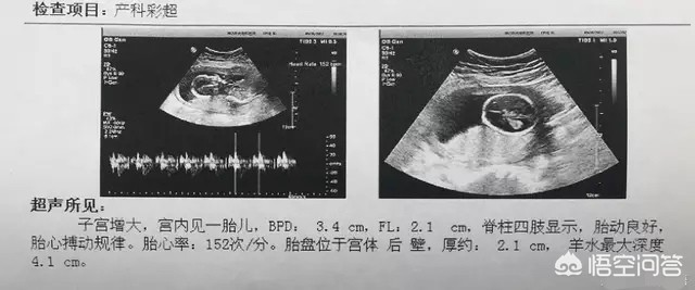 怀孕17周胎儿有多大