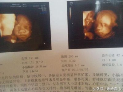 怀孕35天怀男孩症状