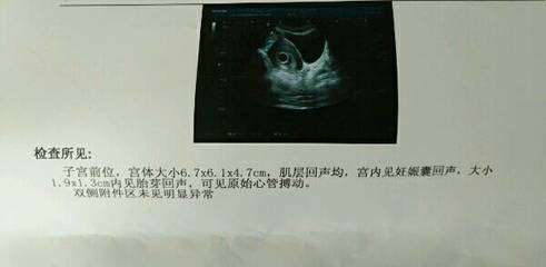 怀孕孕囊图片