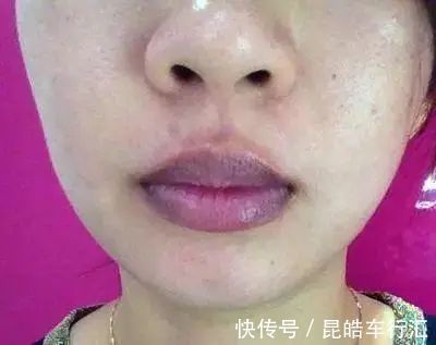 舌头有点肿是怎么回事