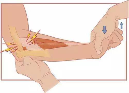 劳累胳膊肘关节疼痛怎么治疗